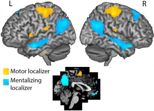 Imagen de resonancia magnética del cerebro por Roel Williams y Annabel Nijhof 